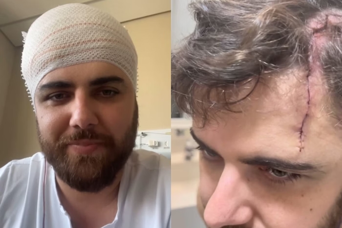 Zé Neto exibe ferimento na cabeça após acidente