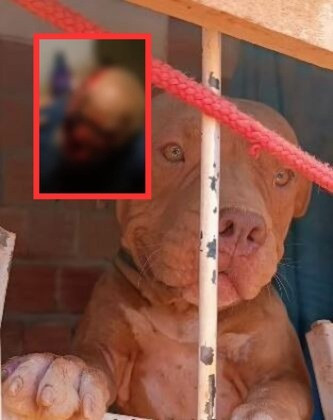 Homem é atacado por pitbull em Cuiabá e fica com metade do rosto desfigurado