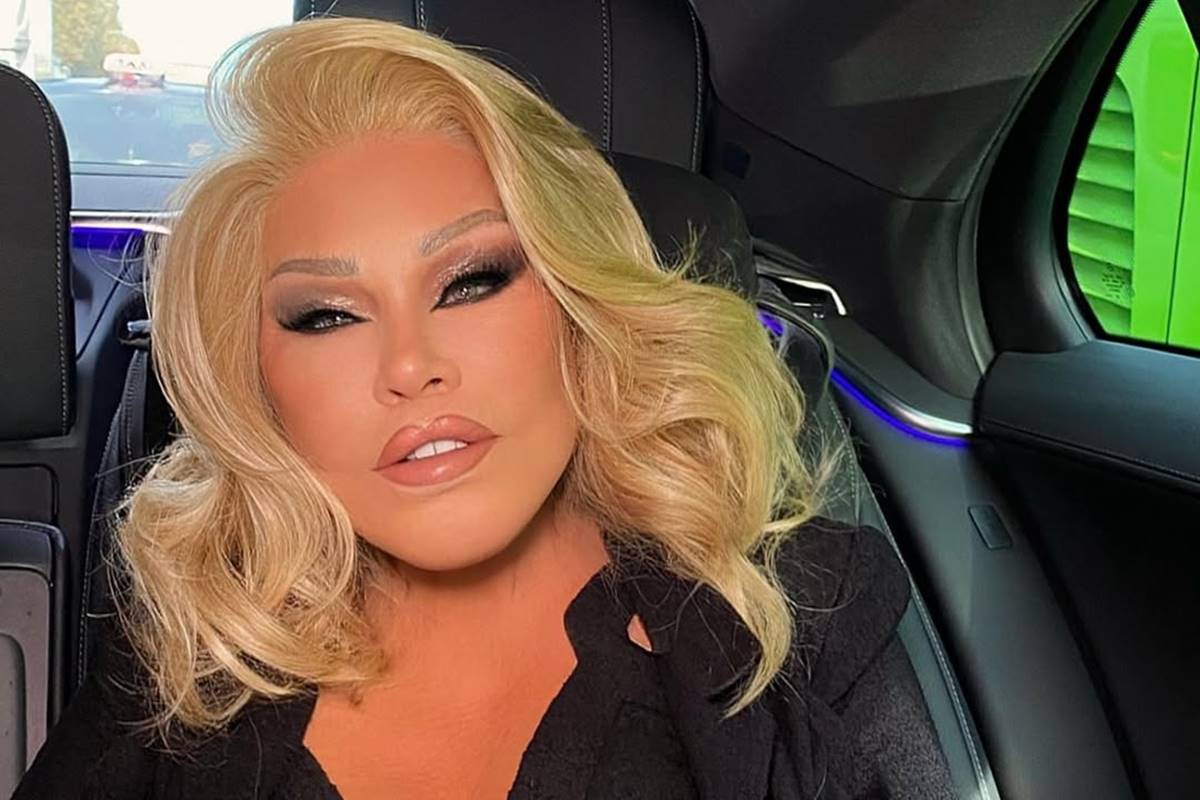 Jocelyn Wildenstein, a "mulher felina", morre aos 79 anos em Paris; VEJA VÍDEO