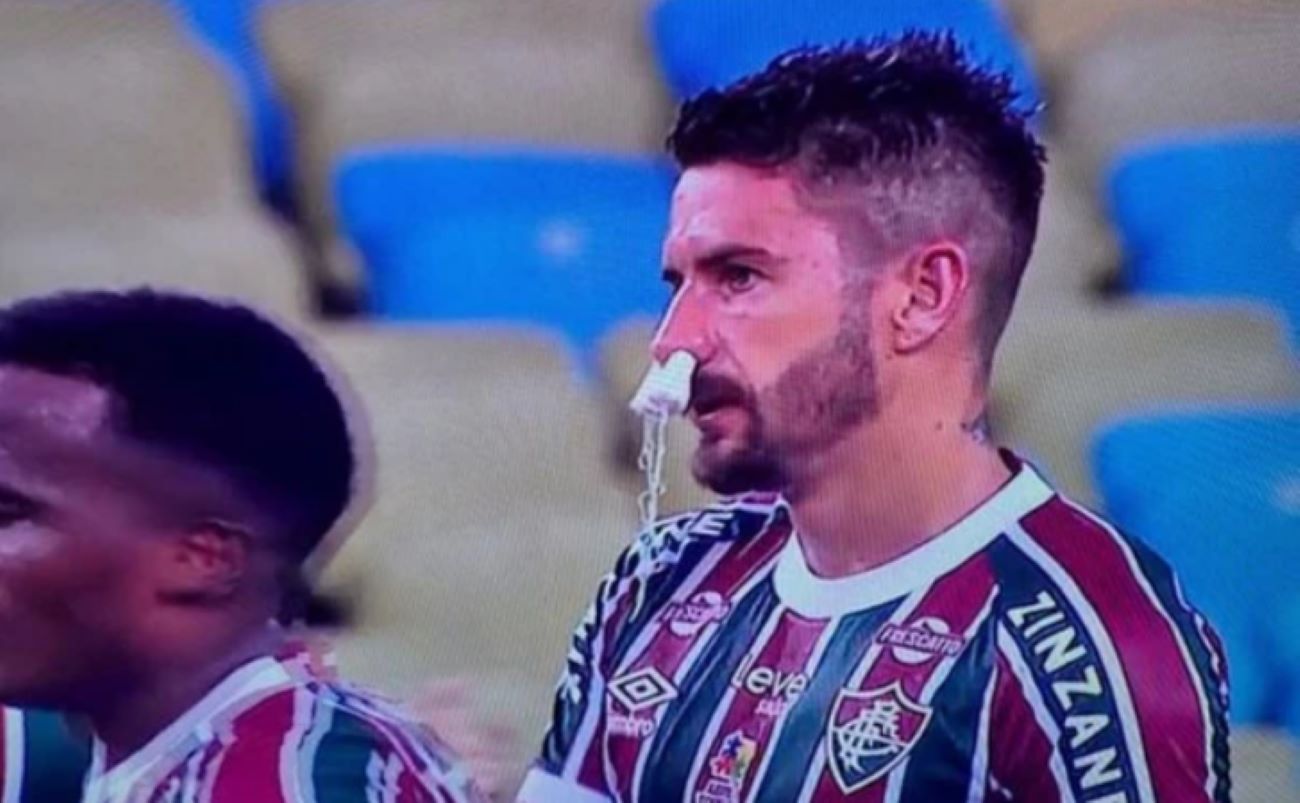 Jogador do Fluminense usa absorvente no nariz e viraliza: entenda o que aconteceu