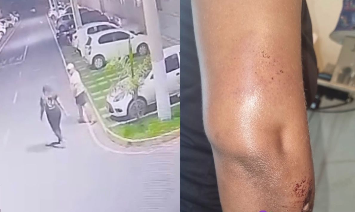 Mulher denuncia dentista por racismo e violência dentro de condomínio