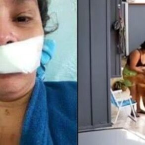Mulher é atacada por cachorro e marido manda matar animal escondido