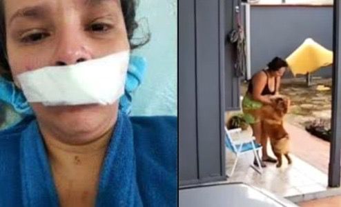 Mulher é atacada por cachorro e marido manda matar animal escondido