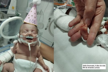 Sofia Nasce Prematura e Vence a Luta Pela Vida