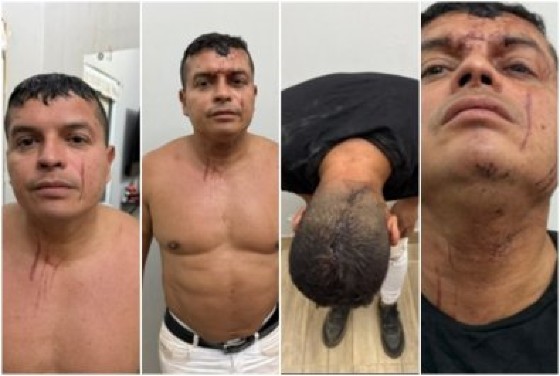 ex-namorada de policial é acusada de agressão brutal